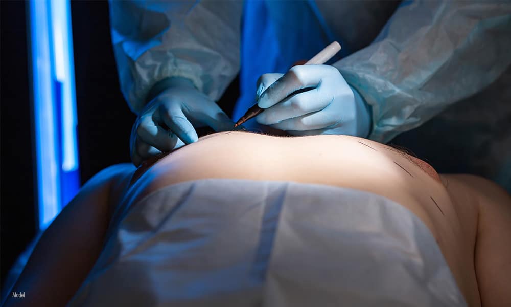 Gynecomastia patient in operating room.